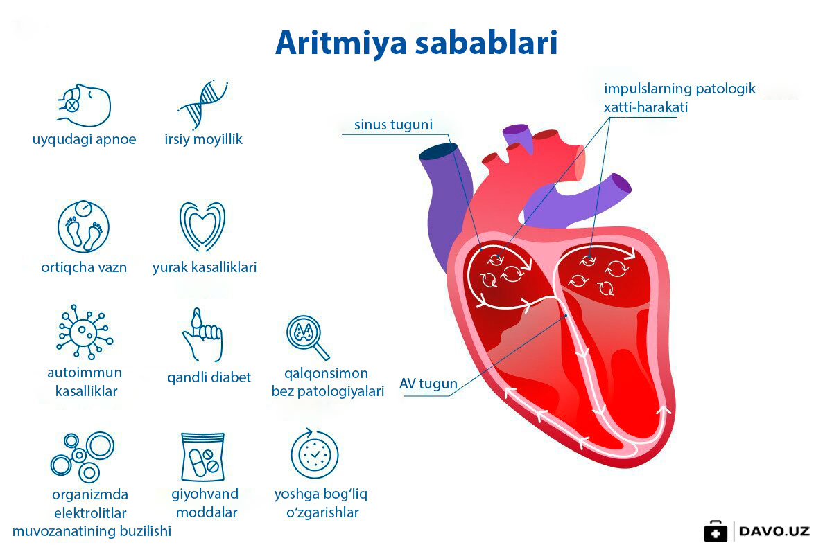 Aritmiya-sabablari